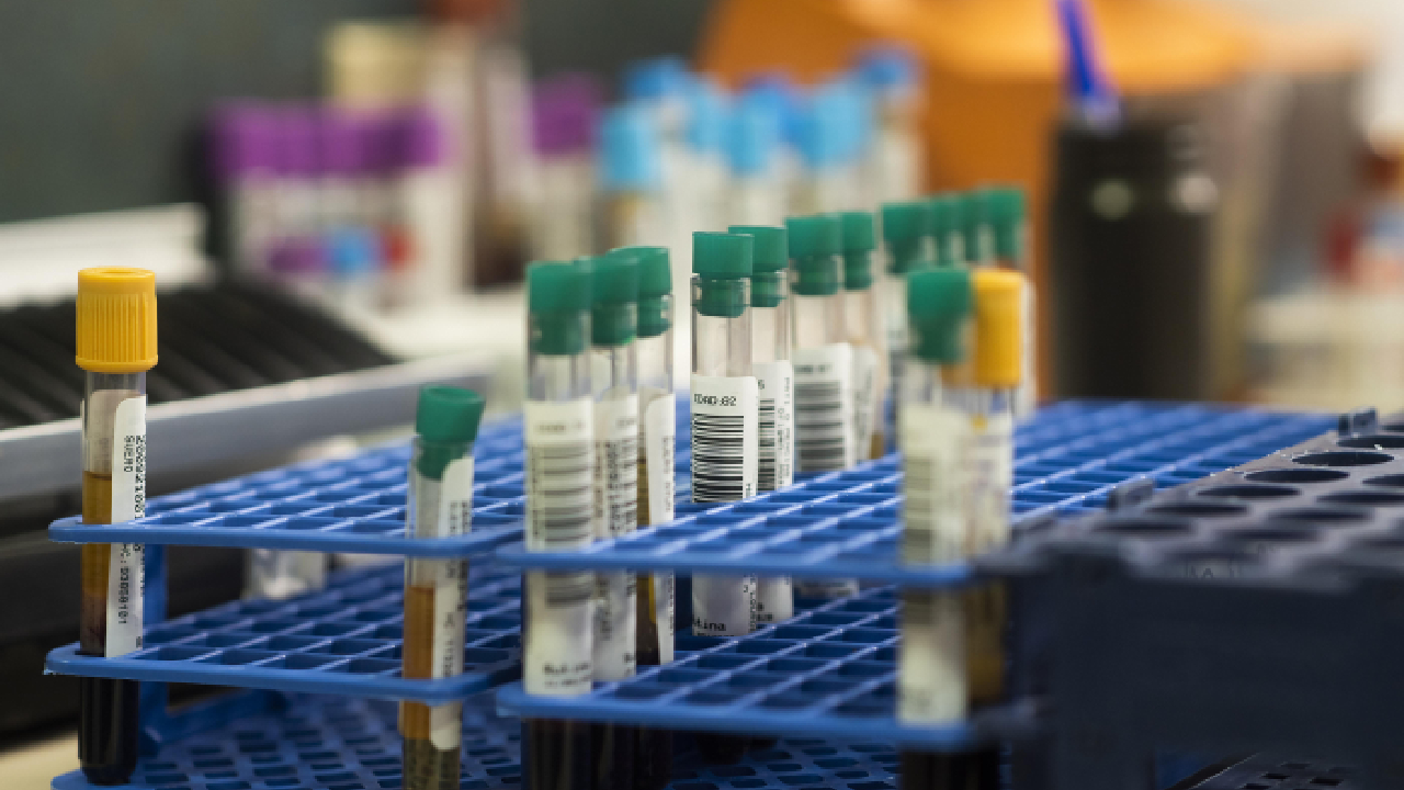 SBS format rack: The Origin Of Microplate Standards.